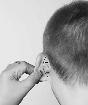 Ear Surgery